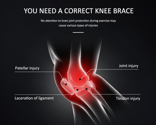An informational graphic on knee brace importance, showing a highlighted human knee joint with labels pointing to patellar injury, joint injury, laceration of ligament, and tendon injury. Large text at the top reads, 'YOU NEED A CORRECT KNEE BRACE' on a dark background.
